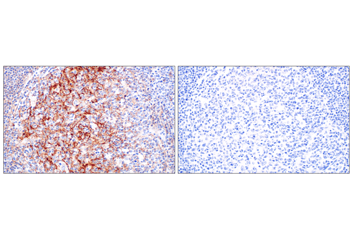 CR1/CD35 (E8B1Z) Rabbit mAb (#96615) Datasheet With Images