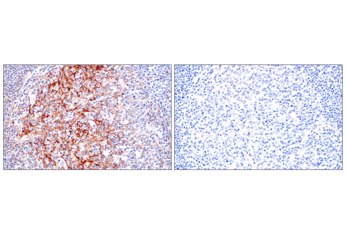 Immunohistochemistry Image 5: CR1/CD35 (E8B1Z) Rabbit mAb