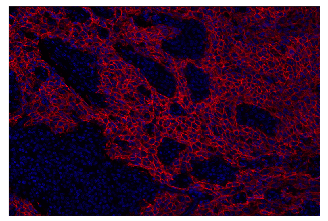 Immunohistochemistry Image 3: TACSTD2/TROP2 (F4W4J) & CO-0150-488 SignalStar<sup>™</sup> Oligo-Antibody Pair