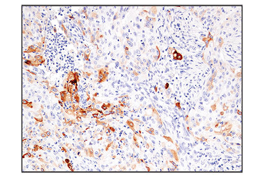 Immunohistochemistry Image 4: IL-13RA2/CD213a2 (E7U7B) Rabbit Monoclonal Antibody