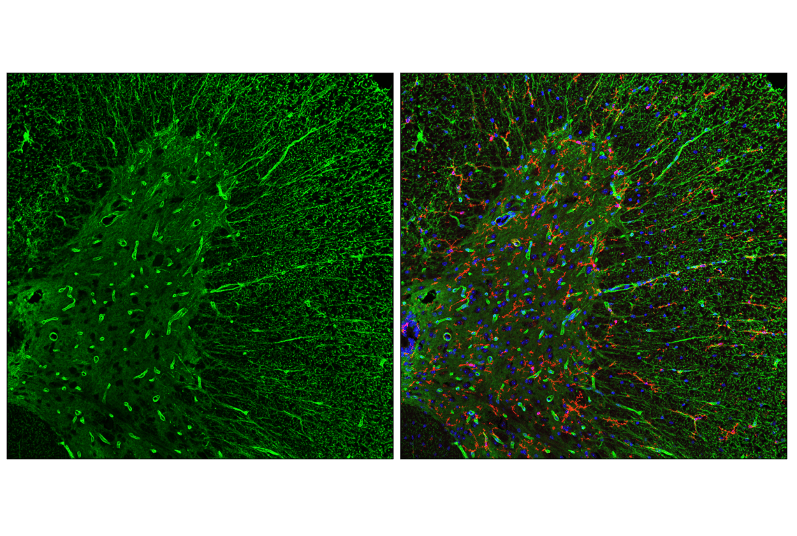 Immunofluorescence Image 2: AQP4 (E4B6T) Mouse Monoclonal Antibody