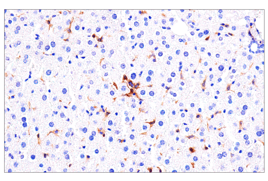 Immunohistochemistry Image 4: Axl (E3Z2H) Rabbit Monoclonal Antibody (BSA and Azide Free)