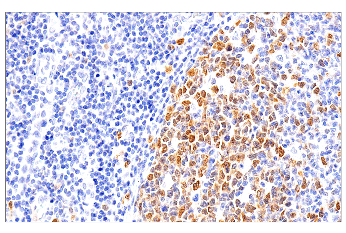 Immunohistochemistry Image 10: Chk1 (2G1D5) Mouse mAb