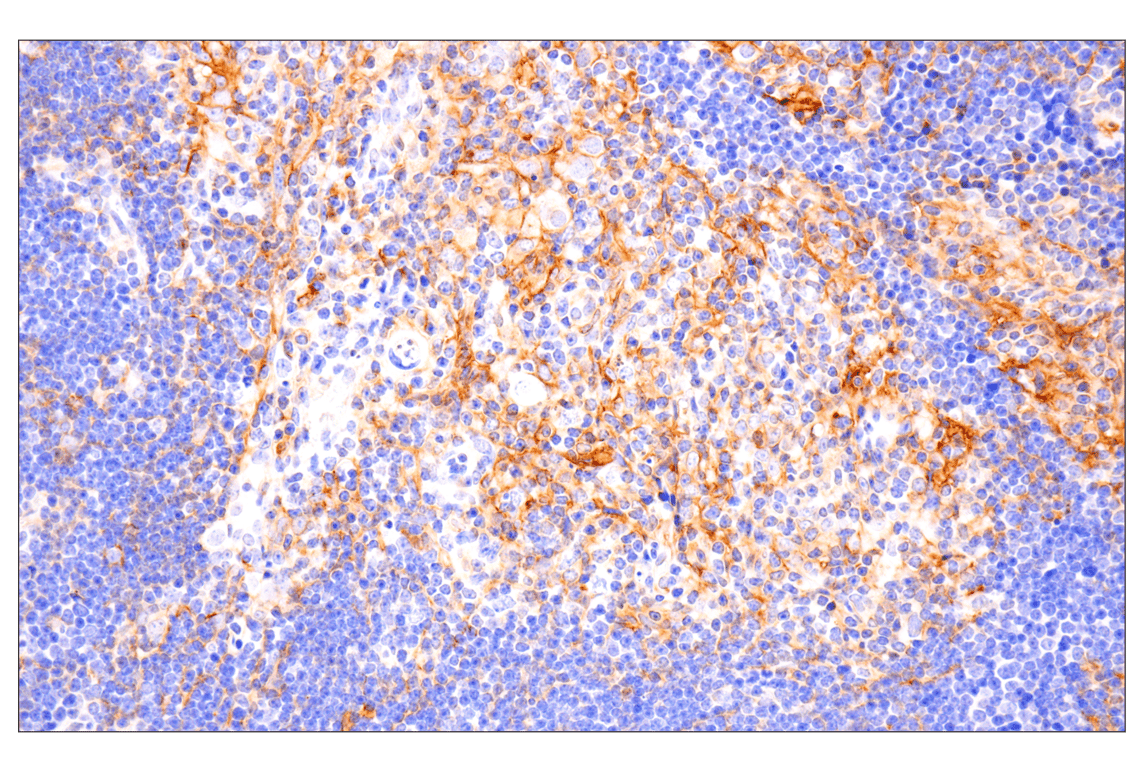 Immunohistochemistry Image 2: PD-L1 (F3Z1T) Rabbit Monoclonal Antibody (IHC Formulated)