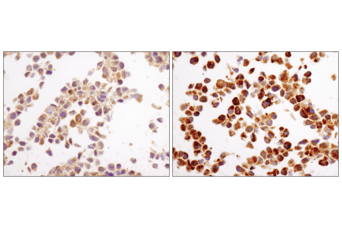 Immunohistochemistry Image 2: LC3A/B (D3U4C) Rabbit Monoclonal Antibody (BSA and Azide Free)