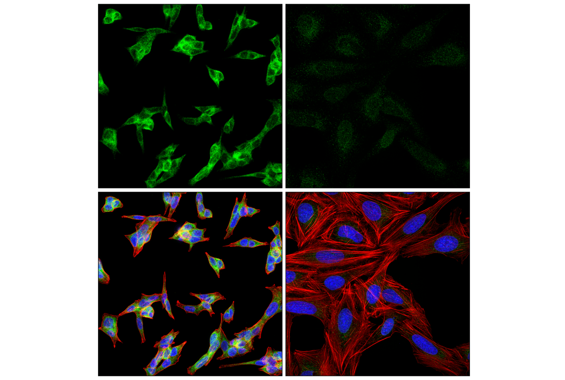 Immunofluorescence Image 1: UFL1 (F5P6L) Rabbit Monoclonal Antibody