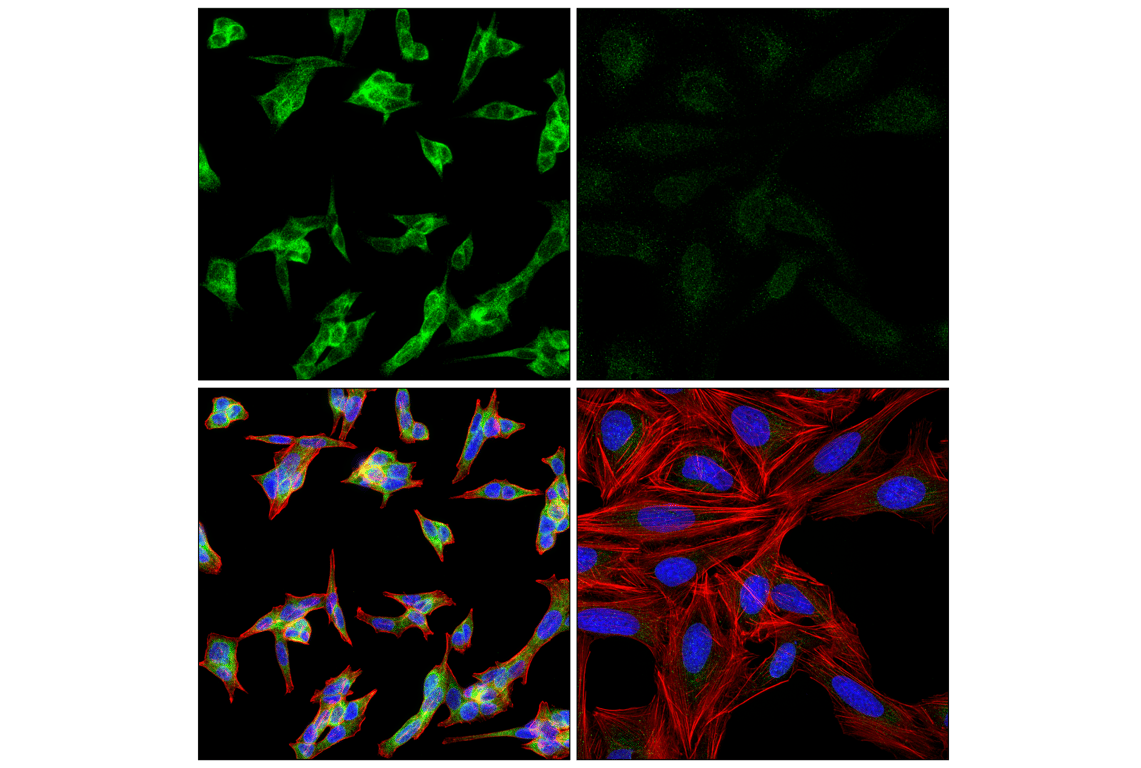 Immunofluorescence Image 1: UFL1 (F5P6L) Rabbit mAb