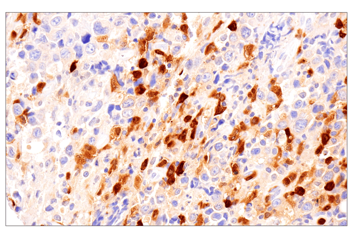 Immunohistochemistry Image 3: APOBEC3A (UMN-13) Rabbit Monoclonal Antibody
