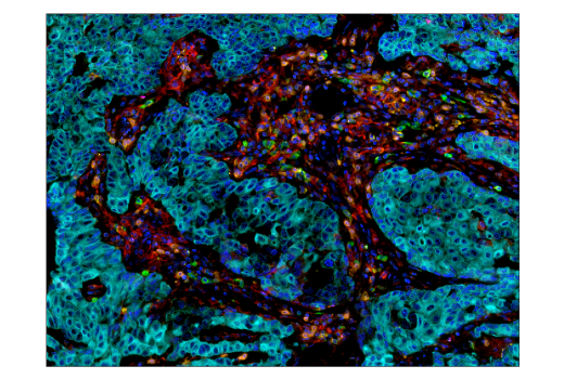 Immunohistochemistry Image 4: PD-1 (Intracellular Domain) (D4W2J) XP<sup>®</sup> Rabbit mAb (BSA and Azide Free)