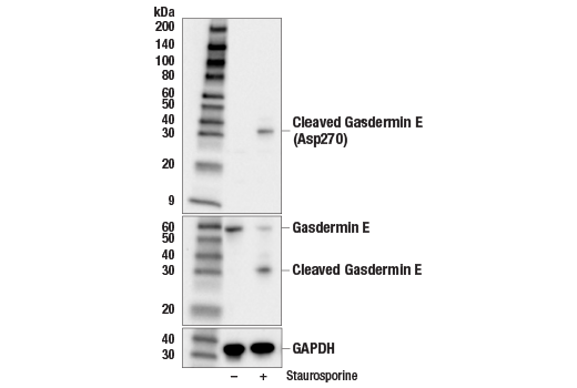 Western Blotting Image 3: Cleaved Gasdermin E (Asp270) (E8G4U) Rabbit Monoclonal Antibody