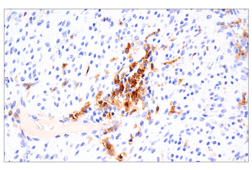 Immunohistochemistry Image 7: GM-CSF Receptor alpha (E8Z3S) Rabbit Monoclonal Antibody (BSA and Azide Free)