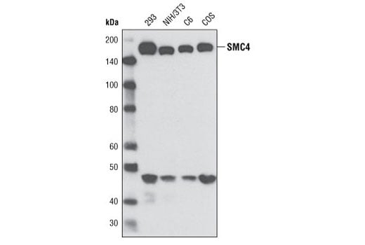 Western Blotting Image 1: SMC4 (D14E2) Rabbit mAb