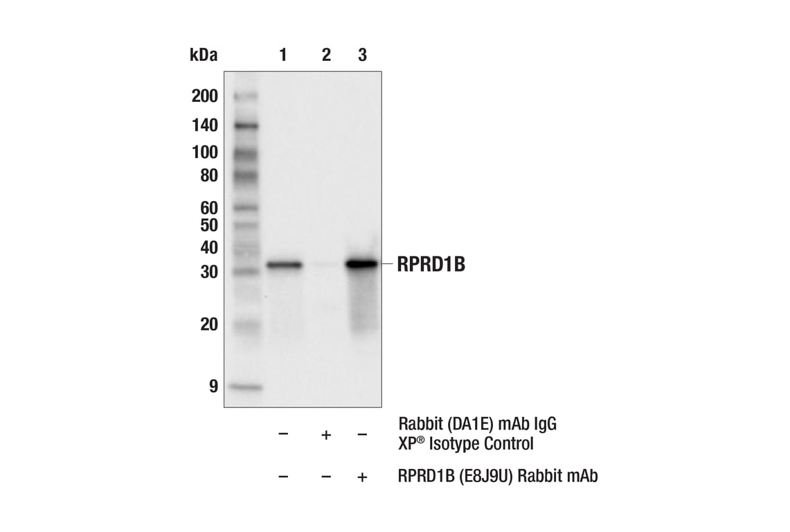Immunoprecipitation Image 1: RPRD1B (E8J9U) Rabbit Monoclonal Antibody