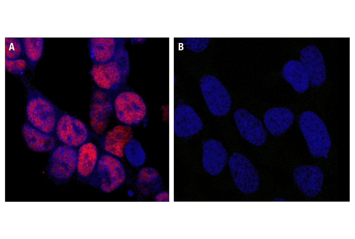 Immunofluorescence Image 1: Phospho-CREB (Ser133) (87G3) Rabbit Monoclonal Antibody