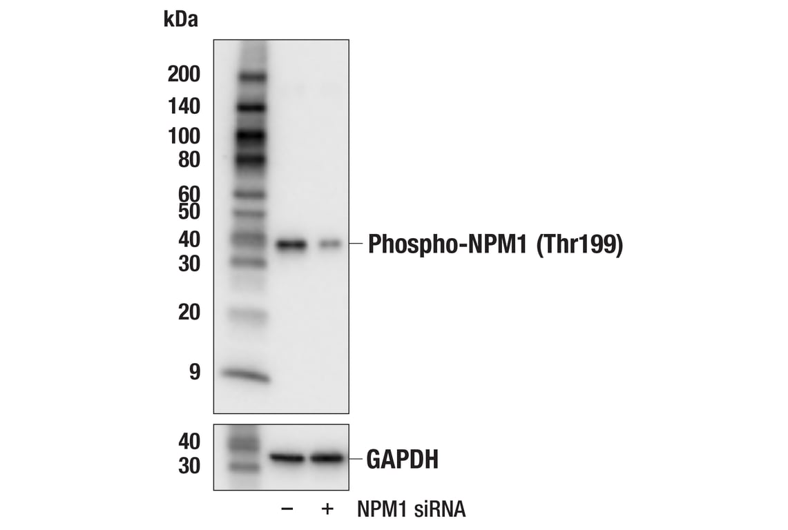 Western Blotting Image 2: Phospho-NPM1 (Thr199) (E4C7S) Rabbit Monoclonal Antibody