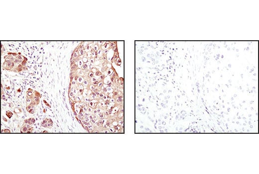 Immunohistochemistry Image 1: 4E-BP1 (53H11) Rabbit Monoclonal Antibody (BSA and Azide Free)