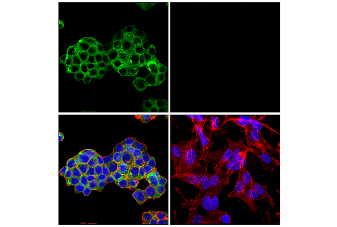 Immunofluorescence Image 1: Desmoplakin (F3J8Y) Rabbit Monoclonal Antibody