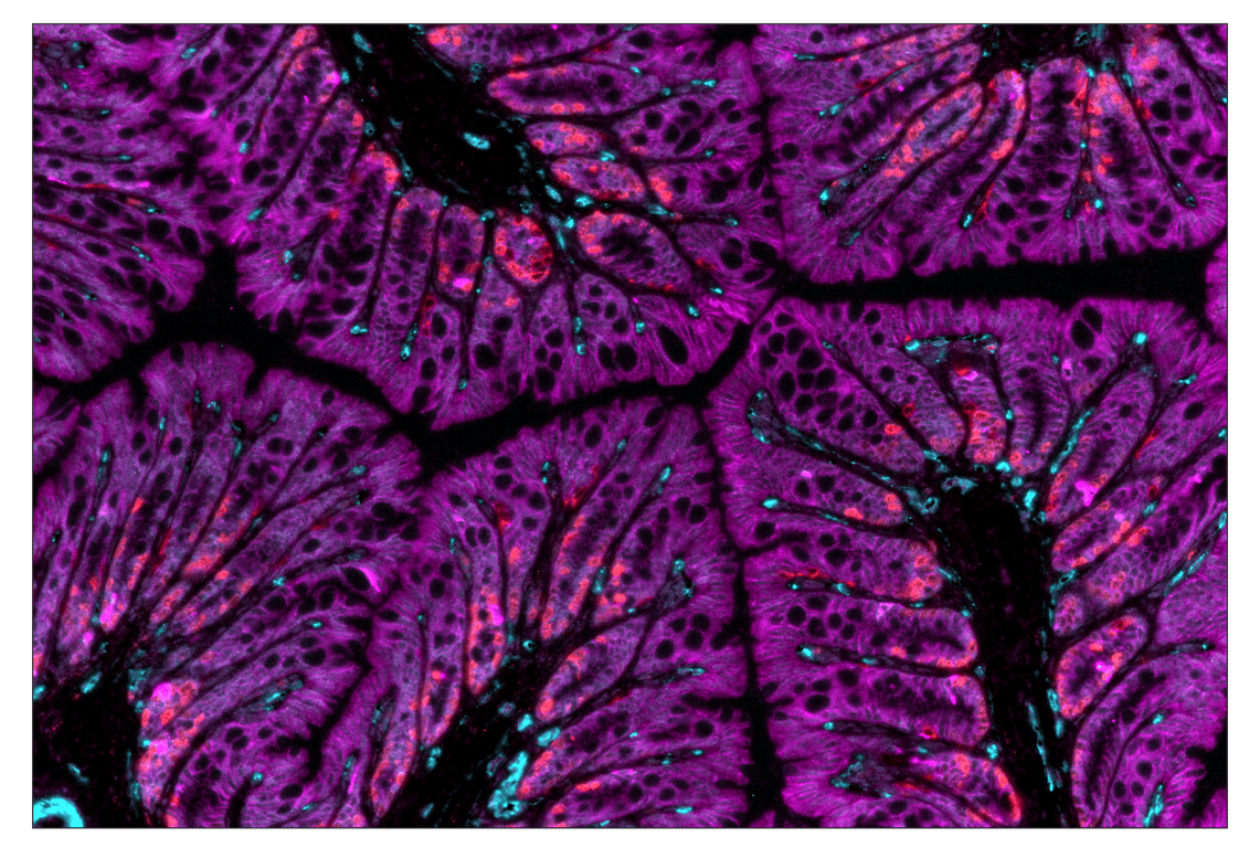 Immunohistochemistry Image 7: HER2/ErbB2 (D8F12) & CO-0059-647 SignalStar<sup>™</sup> Oligo-Antibody Pair