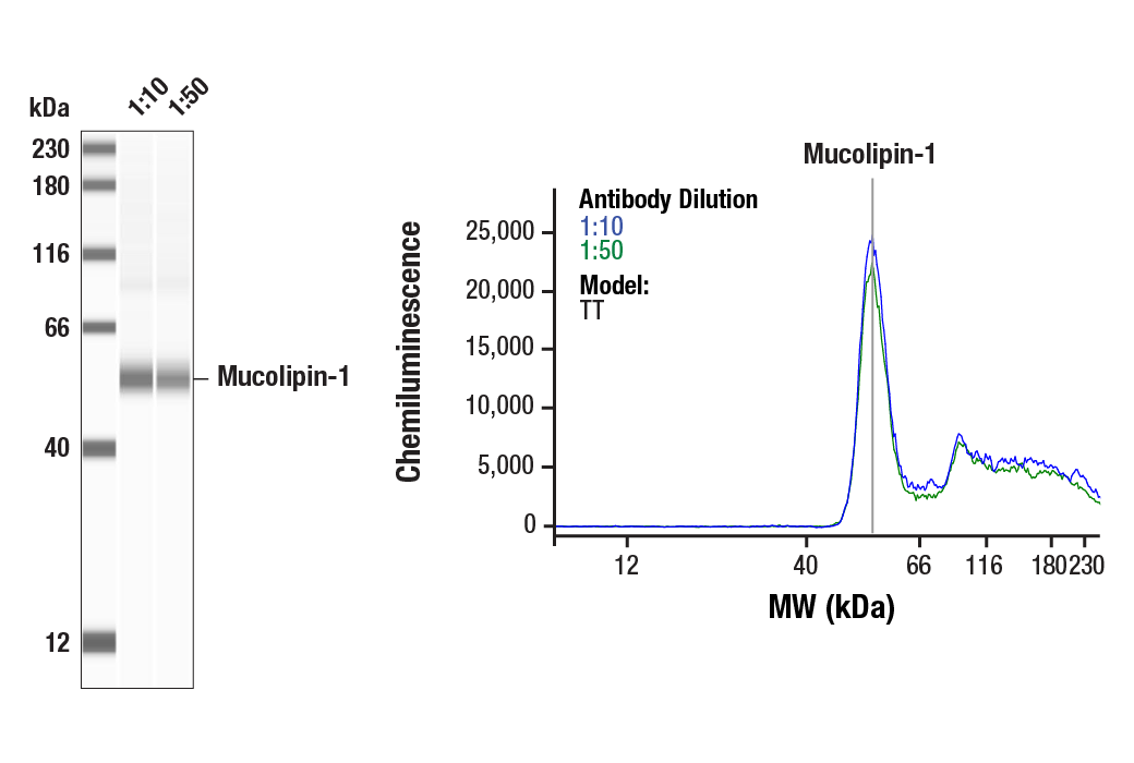 Western Blotting Image 1: Mucolipin-1 Antibody