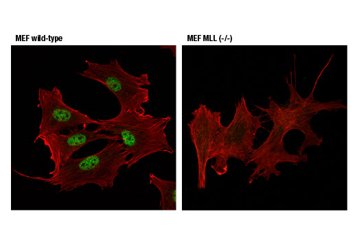 Immunofluorescence Image 1: MLL1 (D6G8N) Rabbit Monoclonal Antibody (Carboxy-terminal Antigen)