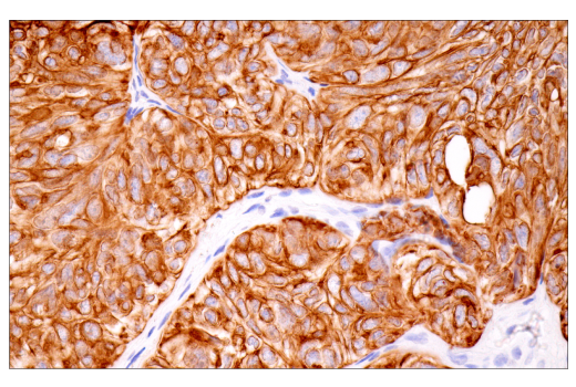 Immunohistochemistry Image 4: Keratin 7 (RN7) Mouse Monoclonal Antibody