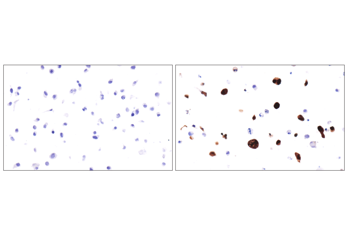 Immunohistochemistry Image 12: FoxP3 (221D) Mouse Monoclonal Antibody
