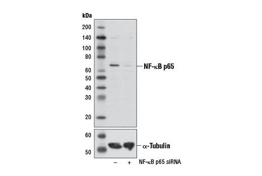 undefined Image 9: NF-kappaB p65 Antibody Sampler Kit