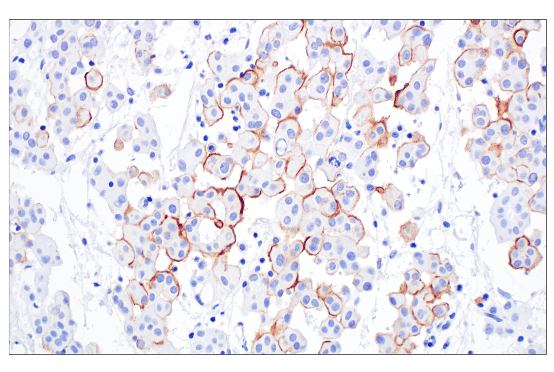 Immunohistochemistry Image 2: UPK3B (DBRRM3.66) Rabbit Monoclonal Antibody
