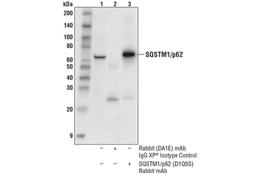 undefined Image 30: p62/KEAP1/NRF2 Pathway Antibody Sampler Kit