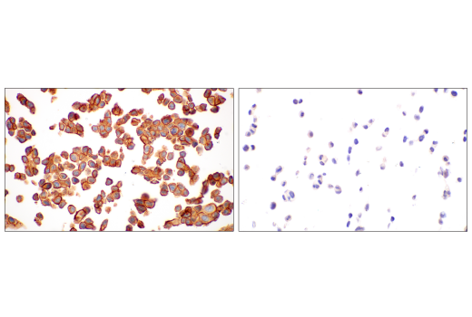 Immunohistochemistry Image 3: CMTM6 (E6A8T) Rabbit Monoclonal Antibody