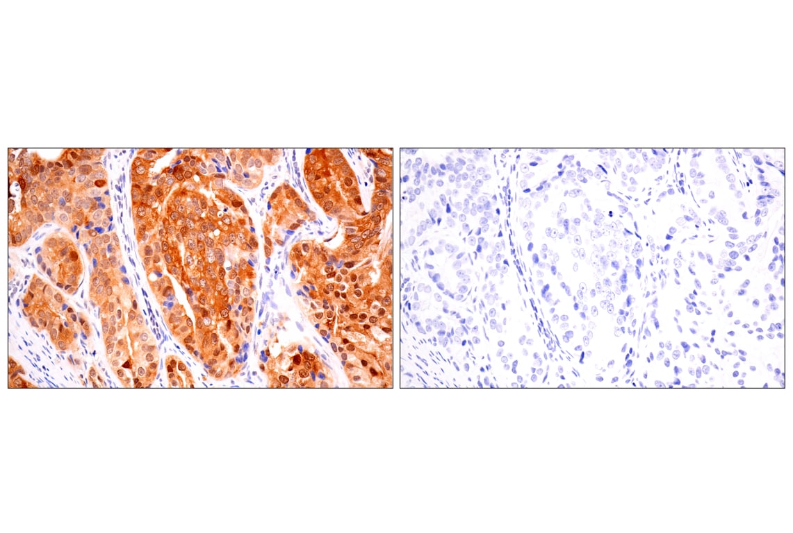 Immunohistochemistry Image 16: ACBP/DBI (E4V8V) Rabbit Monoclonal Antibody
