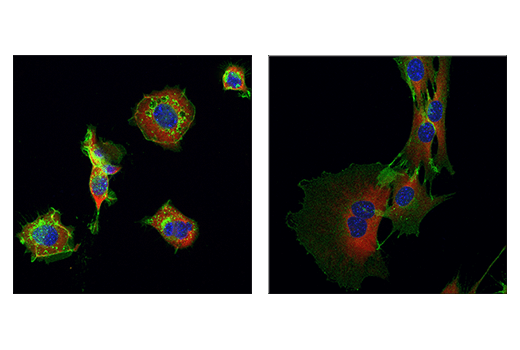 NCAM1 (CD56) (E7X9M) XP® Rabbit mAb | Cell Signaling Technology