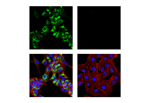 Immunofluorescence Image 1: Neurofilament-M Antibody
