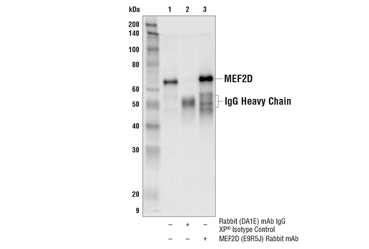 Immunoprecipitation Image 1: MEF2D (E9R5J) Rabbit Monoclonal Antibody
