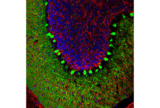 Immunofluorescence Image 1: Calbindin (D1I4Q) XP<sup>®</sup> Rabbit mAb (Alexa Fluor<sup>®</sup> 488 Conjugate)