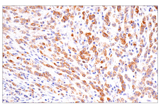 Immunohistochemistry Image 4: Cox2 (D5H5) XP<sup>®</sup> Rabbit mAb (BSA and Azide Free)