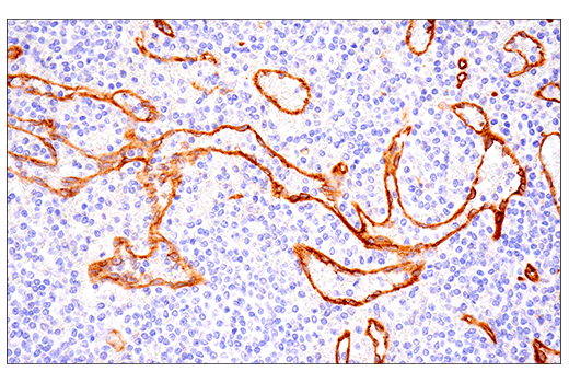 Immunohistochemistry Image 4: Insulin Receptor β (E9L5V) XP<sup>®</sup> Rabbit mAb (BSA and Azide Free)