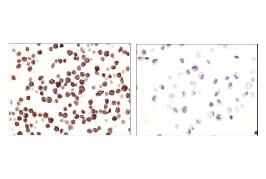 Immunohistochemistry Image 5: CD3 epsilon (D7A6E<sup>™</sup>) Rabbit Monoclonal Antibody