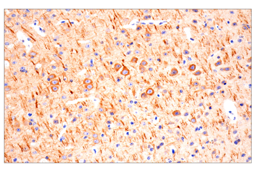 Immunohistochemistry Image 9: CTHRC1 (E8M9S) Rabbit Monoclonal Antibody