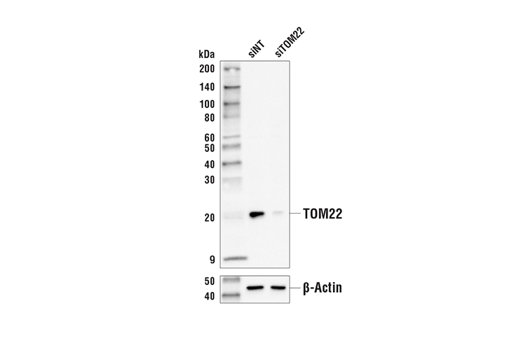 Western Blotting Image 2: TOM22 (E3F4M) Rabbit Monoclonal Antibody