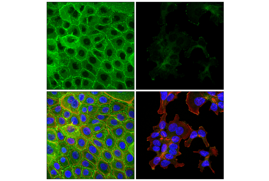 Immunofluorescence Image 1: VASP (F3S3F) Rabbit Monoclonal Antibody