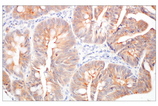 Immunohistochemistry Image 3: GUCY2C (E6I2U) Rabbit Monoclonal Antibody