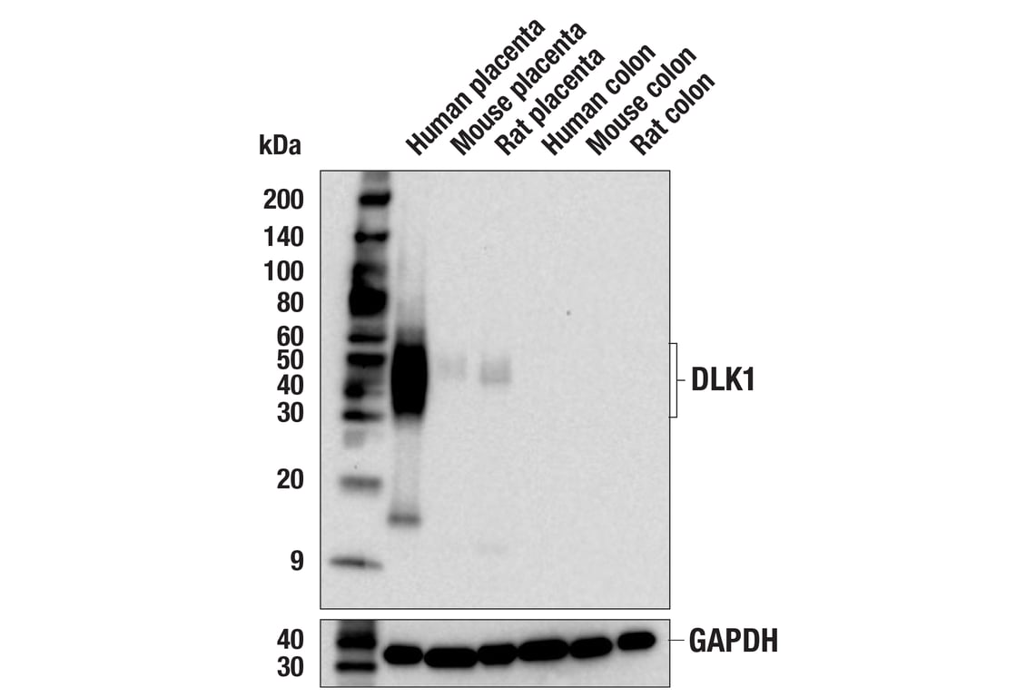 Western Blotting Image 2: DLK1 (F8J8Y) Rabbit Monoclonal Antibody