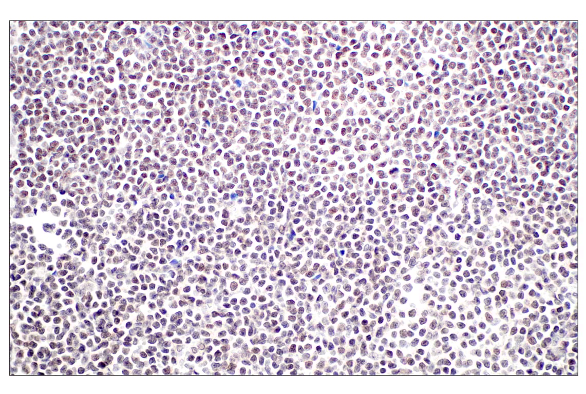 Immunohistochemistry Image 2: Menin (E5P1R) Rabbit Monoclonal Antibody