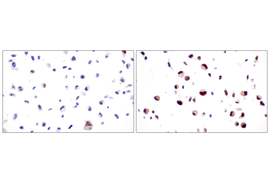 Immunohistochemistry Image 10: MDM2 (F7W7X) Rabbit Monoclonal Antibody