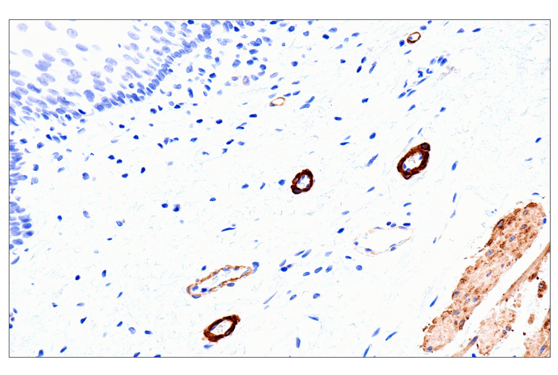 Immunohistochemistry Image 7: MYH11 (E4N8M) Rabbit Monoclonal Antibody (BSA and Azide Free)