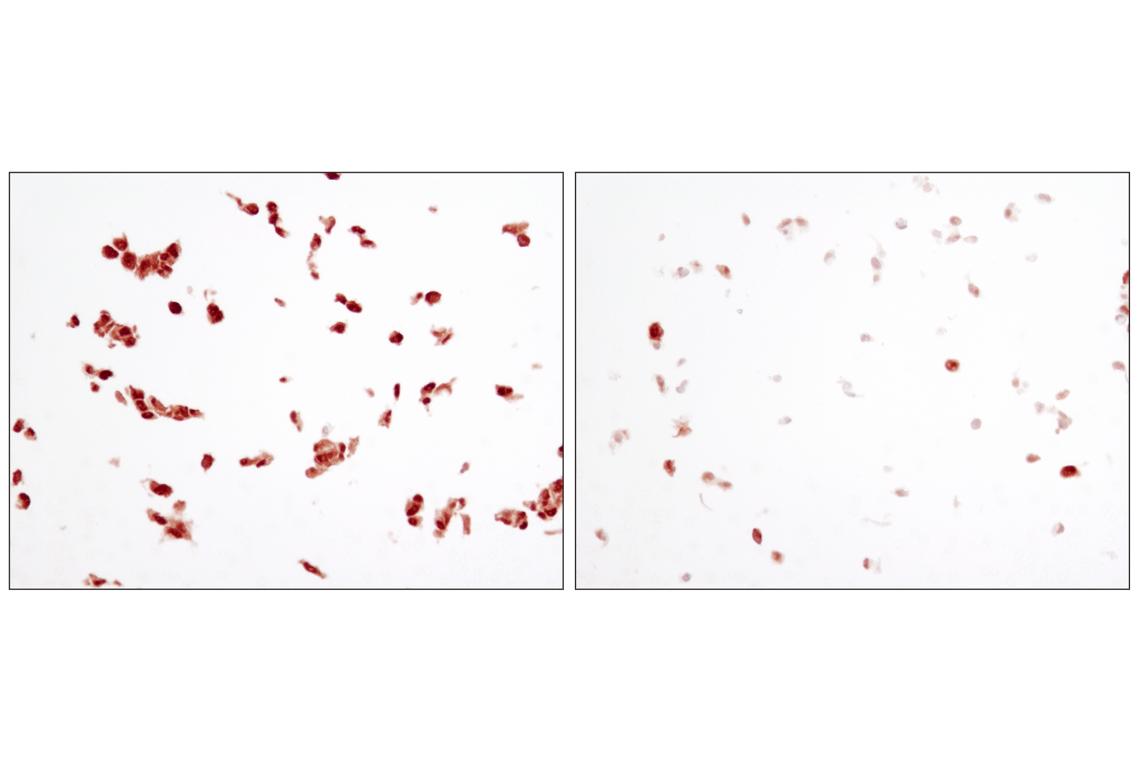 undefined Image 14: NF-kappaB p65 Antibody Sampler Kit