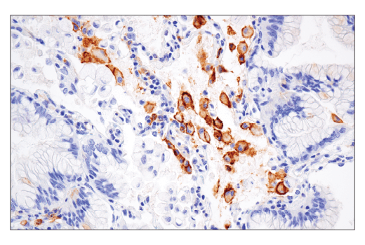 Immunohistochemistry Image 1: CD86 (E2G8P) Rabbit Monoclonal Antibody