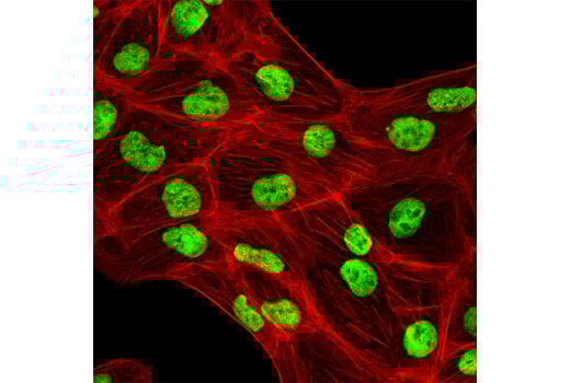 Immunofluorescence Image 1: KAP-1 (C42G12) Rabbit Monoclonal Antibody (BSA and Azide Free)