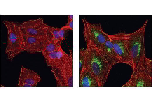 Immunofluorescence Image 1: beta-IG-H3 Antibody